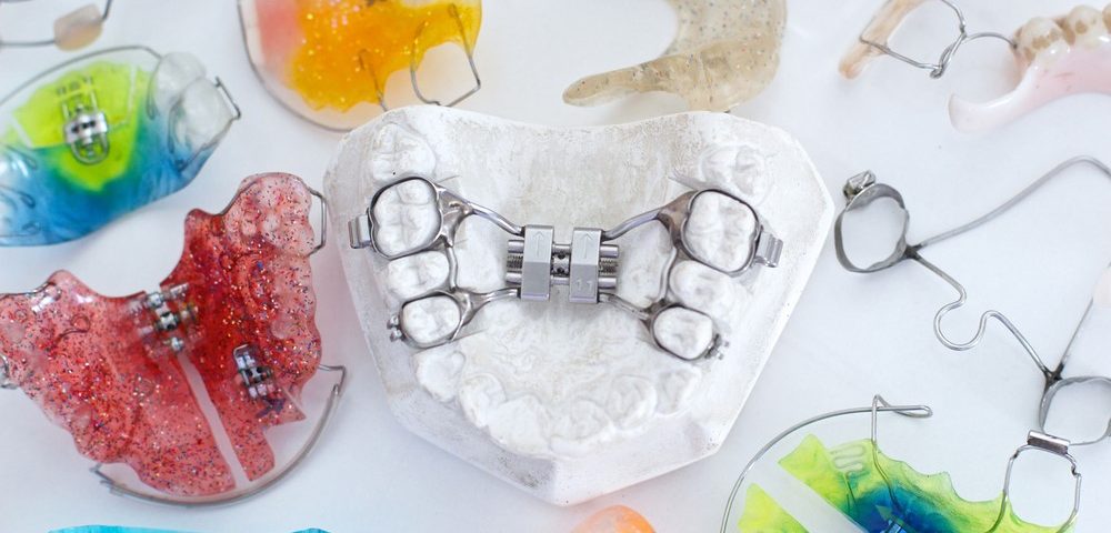 Изготовление ортодонтического аппарата