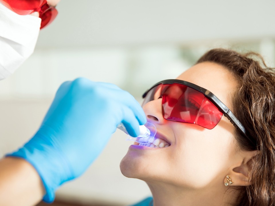 Отбеливание зубов